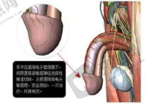 广州鼻修复医生排名前十|广州鼻修复哪个医生好？这份避坑指南请收好