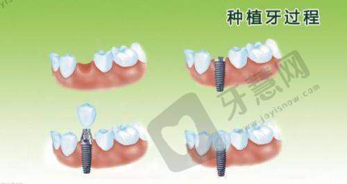 保定优戈正立口腔门诊预约挂号