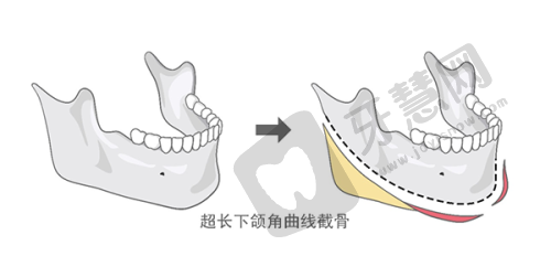 四、新桥口腔在国内十大口腔连锁排名中的特色