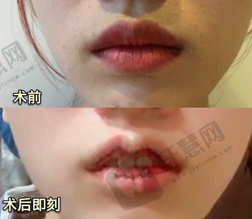 二、廊坊艾美皮肤激光整形医疗美容:科技与美的理想融合
