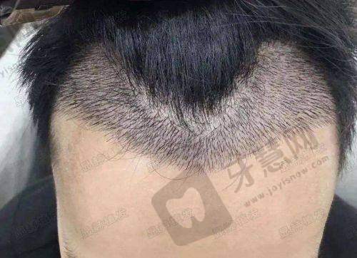 如何选择适合自己的整形医院?