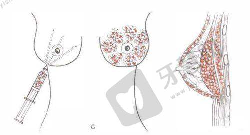 张维医生技术水平高