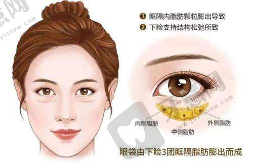 惠州诗璐医疗美容:一针去富贵包技术的佼佼者