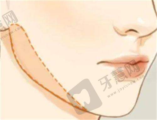 真实实例分享：激光美容成效见证