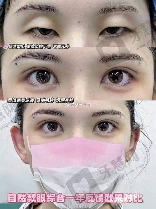 无锡坤如玛丽整形孔庆宋医生简介