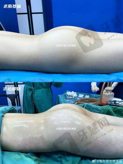 秦珊医生价格表(2025年全新)