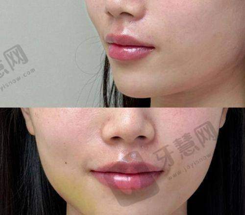 秦珊医生口碑评价及反馈内容