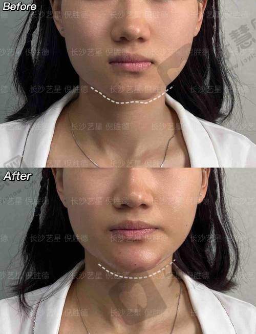 秦珊医生预约挂号