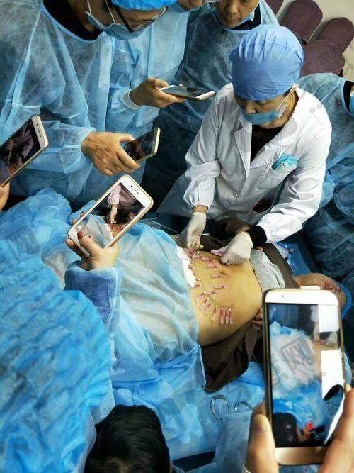 陈果医生收费价目表（2025年全新）