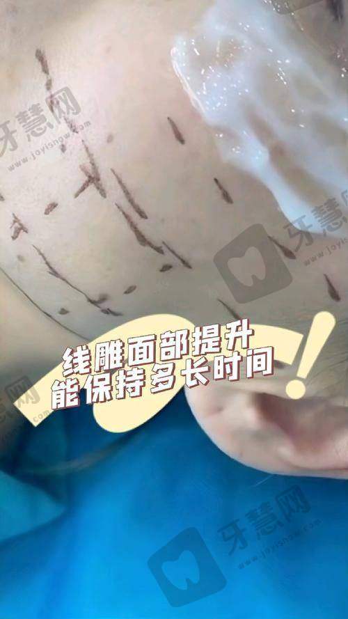 陈果医生预约挂号