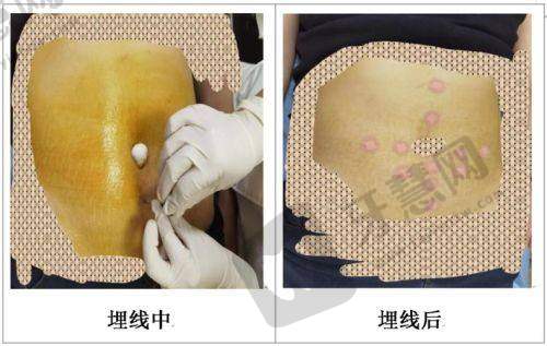 陈果医生擅长项目