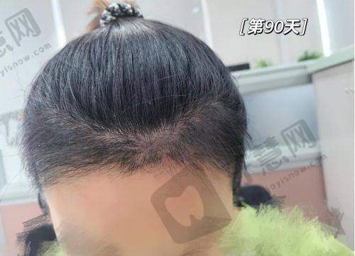 吕永胜医生实例