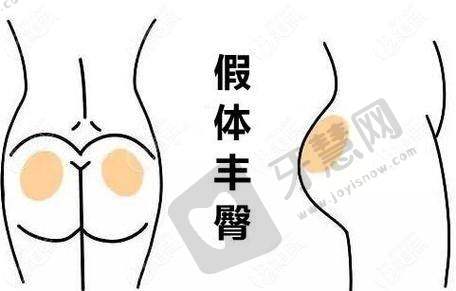 秦珊医生坐诊哪个医院?