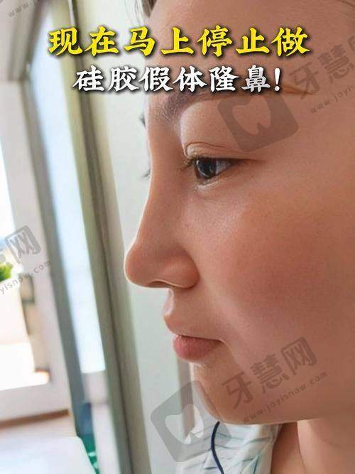 李信锋预约挂号:三种通道便捷预约具有影响力骨干医生