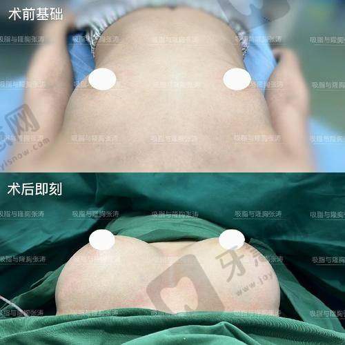 崔培培医生属于什么级别