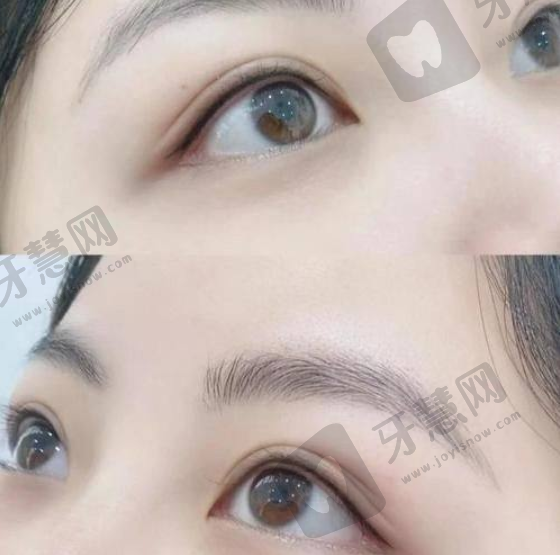 陈嘉文医生技术水平高