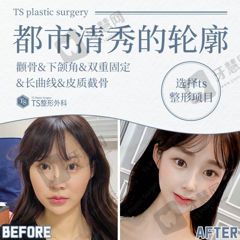 2026国内爱贝芙授权认证医生——朱葛勇