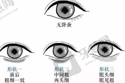 廖轶平医生技术优势
