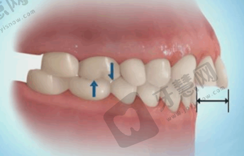 6. 武汉牙达人口腔医院