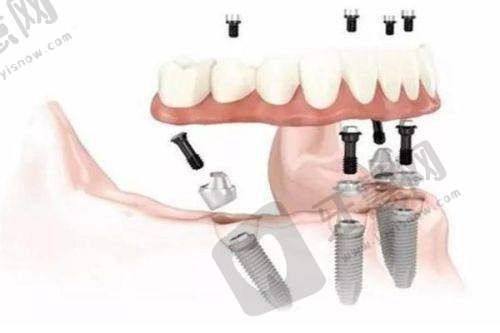 7. 武汉咿呀口腔