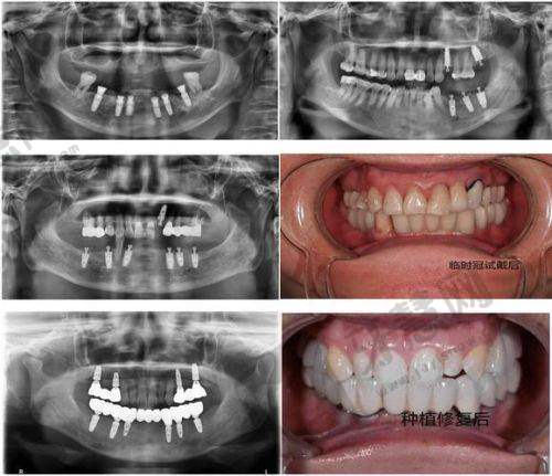 2、延吉牙博士口腔——性价比之王