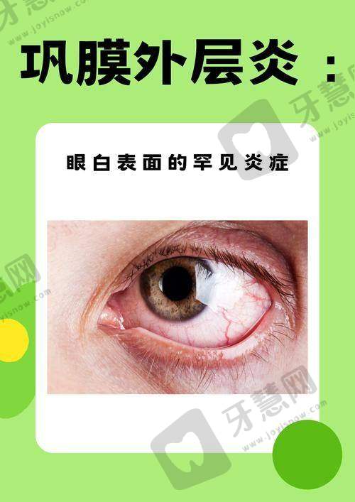 北京同仁医院眼科检查项目费用明细