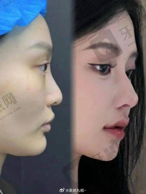 深圳今喜医疗美容门诊特色技术
