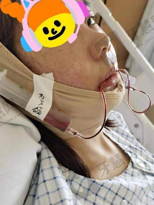 深圳美澳(原美奥)口腔医院价格表