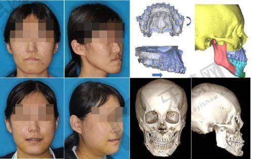 深圳美澳(原美奥)口腔医院预约挂号