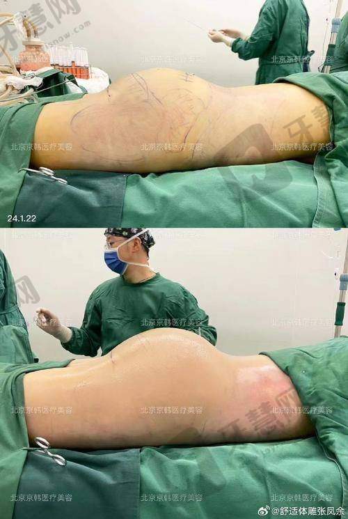 深圳鹏爱整形医院诊疗项目