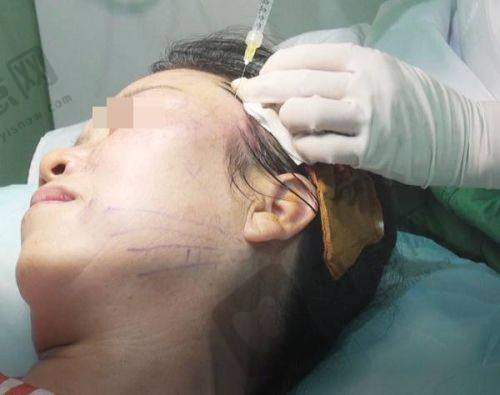 深圳依美医疗美容门诊医院特色技术