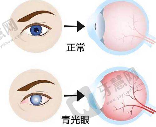 潮州爱尔眼科医院价格表:价格合理,透明收费