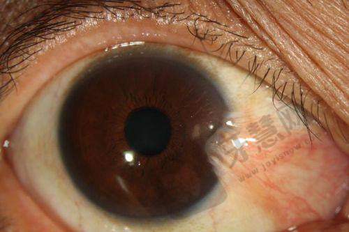 中 国科学 院大学深圳医院(东院区)眼科预约挂号