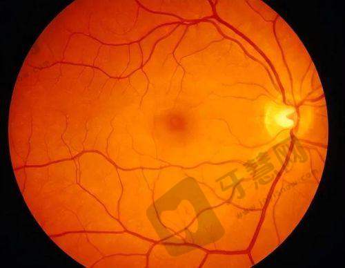 潮州爱尔眼科医院口碑好不好:真实评价,口碑良好