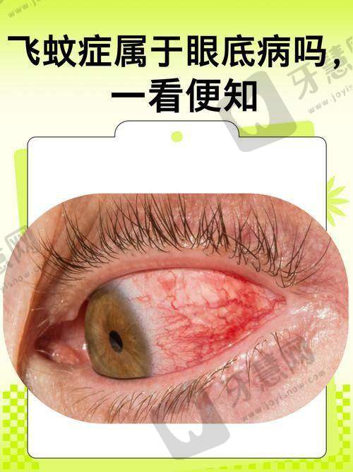 四、舟山爱尔眼科医院项目特色:满足多样化眼科需求