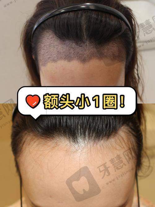 深圳九州植发医院正规吗?
