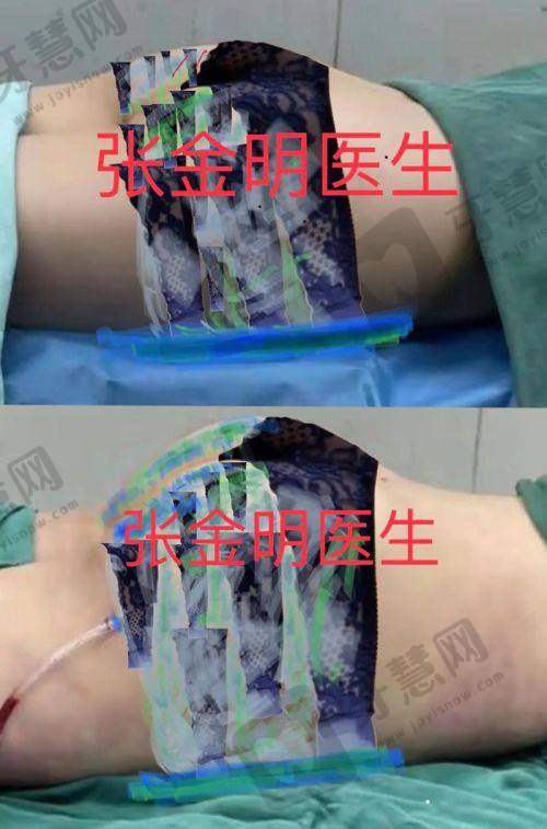 深圳柏颜医疗美容(轻医美)医院价格表