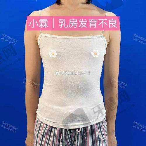 深圳美博瑞整形医院价格表