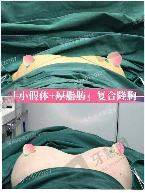 深圳鹏爱整形医院预约挂号