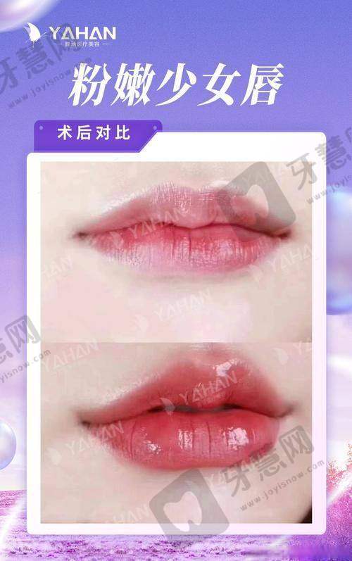深圳春天阳光整形医院口碑如何