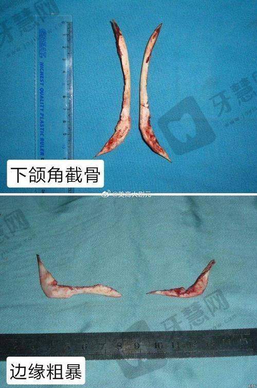 深圳美博瑞整形医院预约挂号