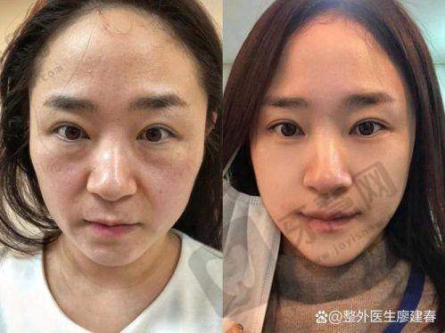 深圳春天阳光整形医院是国有的吗?
