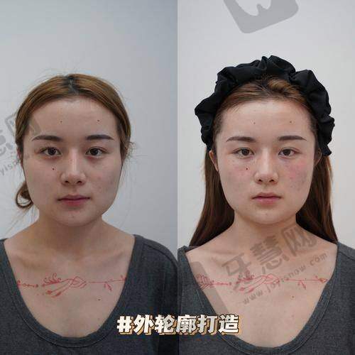 深圳柏颜医疗美容(轻医美)医院特色技术