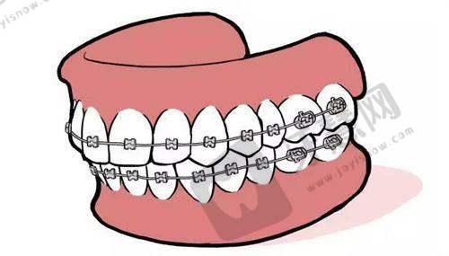 隋强医生做完手术的感觉