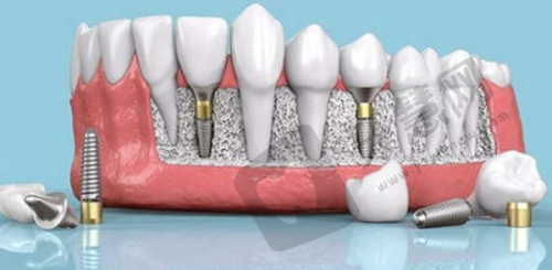 张欣医生手术费用情况