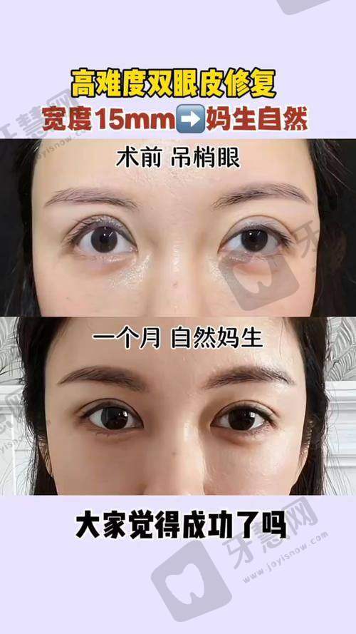 张人波医生技术优势