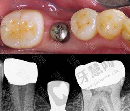 白若飞医生真实评价