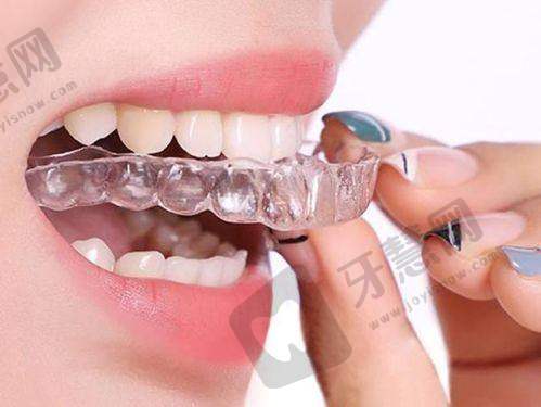 王润丽医生口碑和评价——患者认可的优质服务