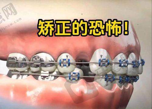 杜欣烨医生真实评价