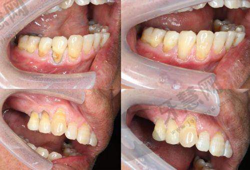 二、杨慧中医生简历